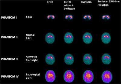 Frontiers | Faster Acquisition for Dopamine Transporter Imaging Using